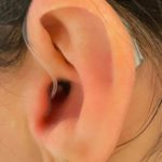 apparecchi acustici invisibili