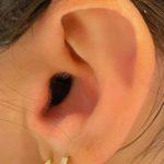 apparecchi acustici invisibili
